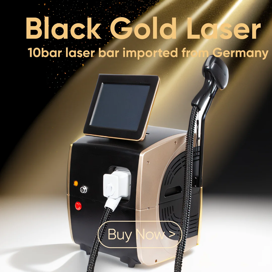 Диодный лазер 808 нм сопрано для омоложения кожи 3 длины волны 755 1064 6000 Вт