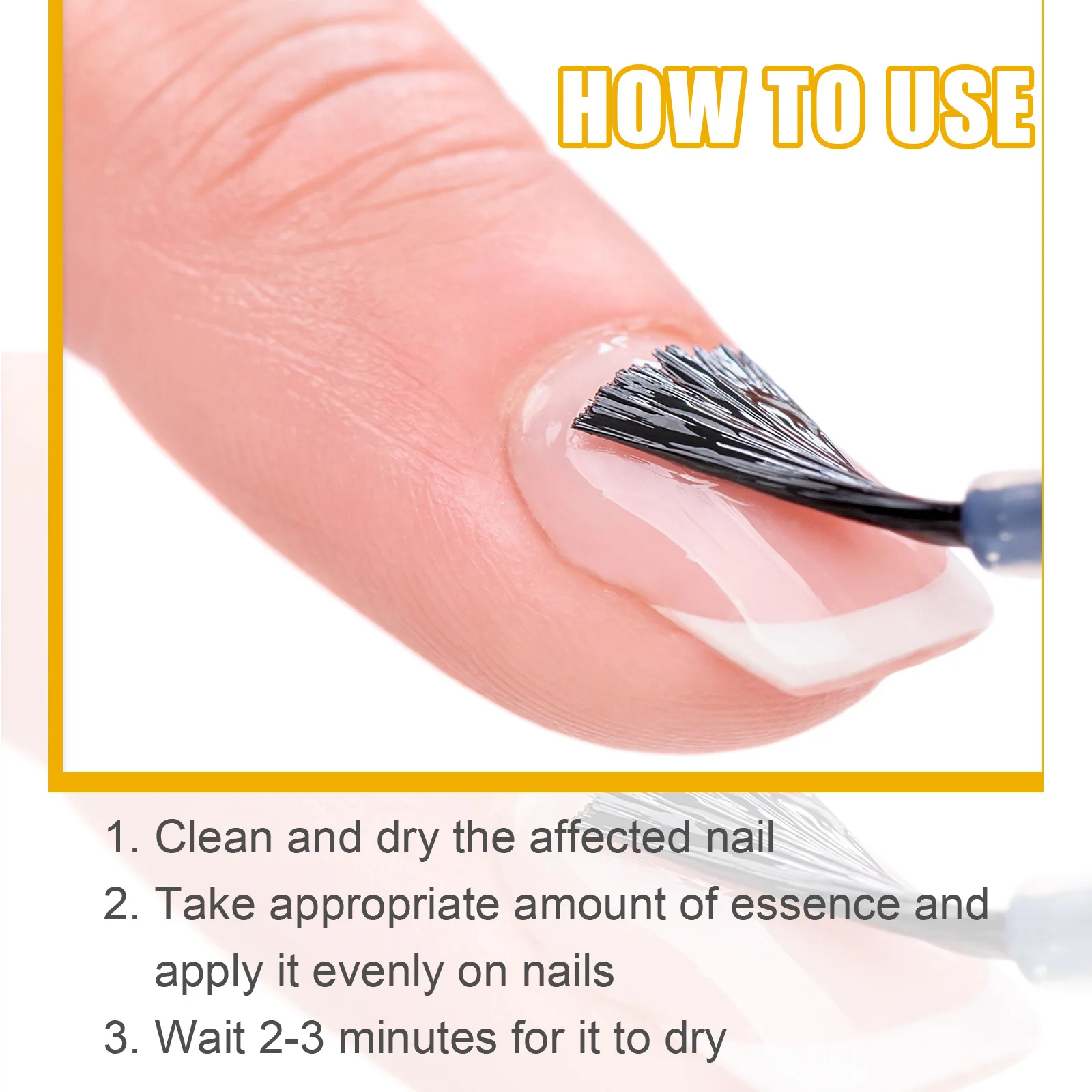 онихомикоз удаление рук ног ремонт уход за ногтями лечение грибка паронихии