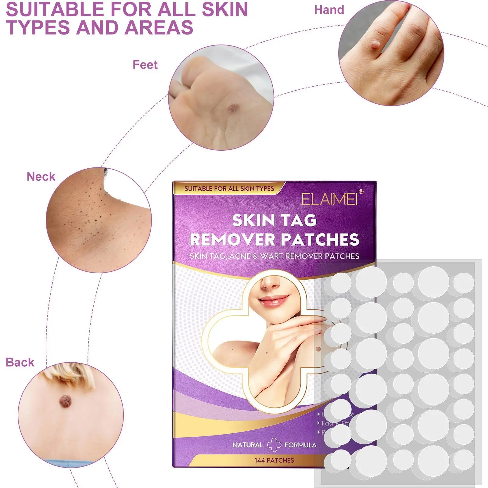 

Ярлык для кожи, искусственные косметические средства для лечения акне, невидимые патчи для лечения ног, 144 шт.