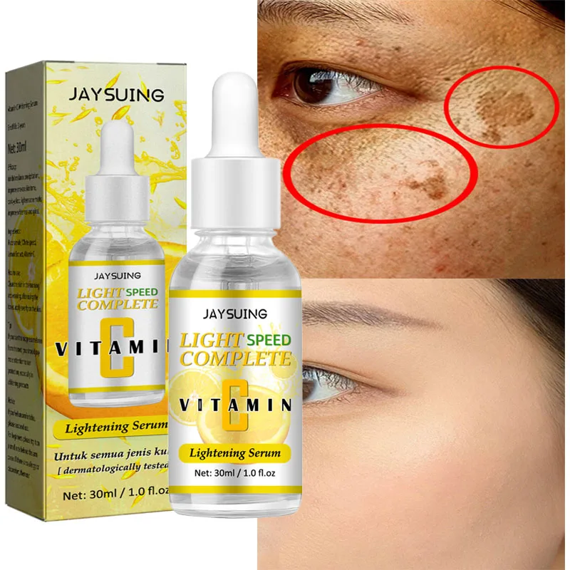

Whitening Freckle Serum Remove Dark Spots Melanin Melasma Brighten Face Essence Pigmentation Anti Aging Skin Care Cosmetics 30ML