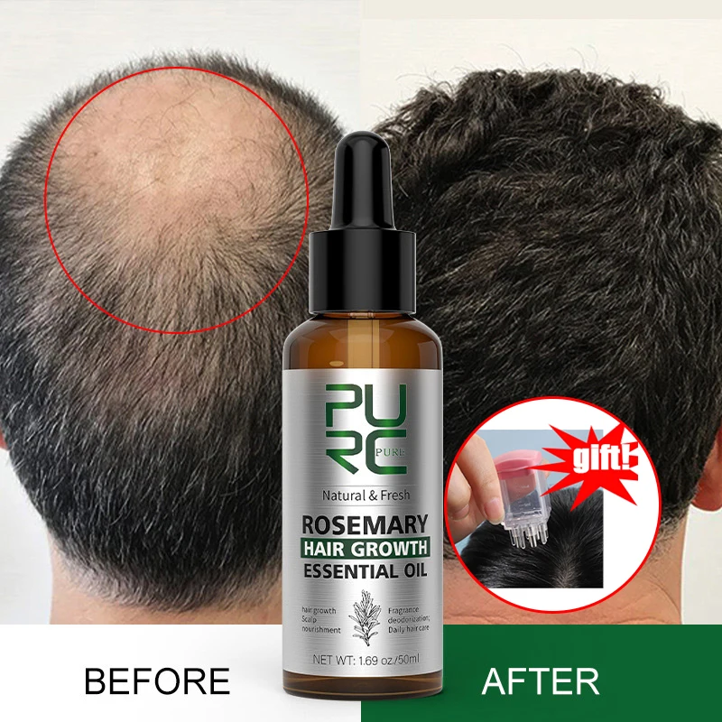 

PURC Rosemary Hair Growth Oil Ginger Herbal Extract Fast Hair Growing Essence Anti Hair Loss Baldness Scalp Hair Treatment Oil