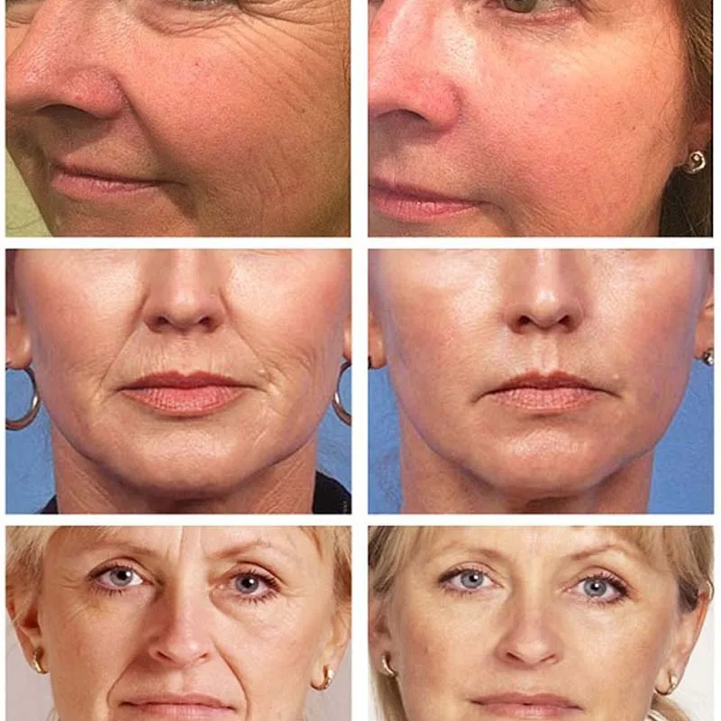 Рисунок 2 - Крем для лица с эффектом потертости и отбеливания