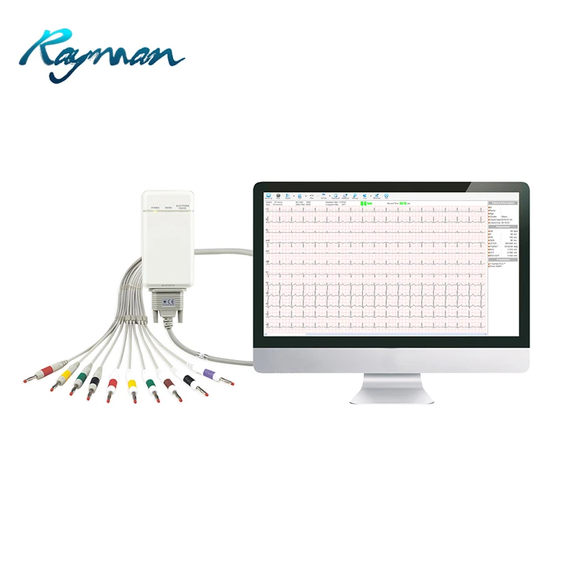 Портативная беспроводная беговая дорожка и Эргометр для ЭКГ-терапии