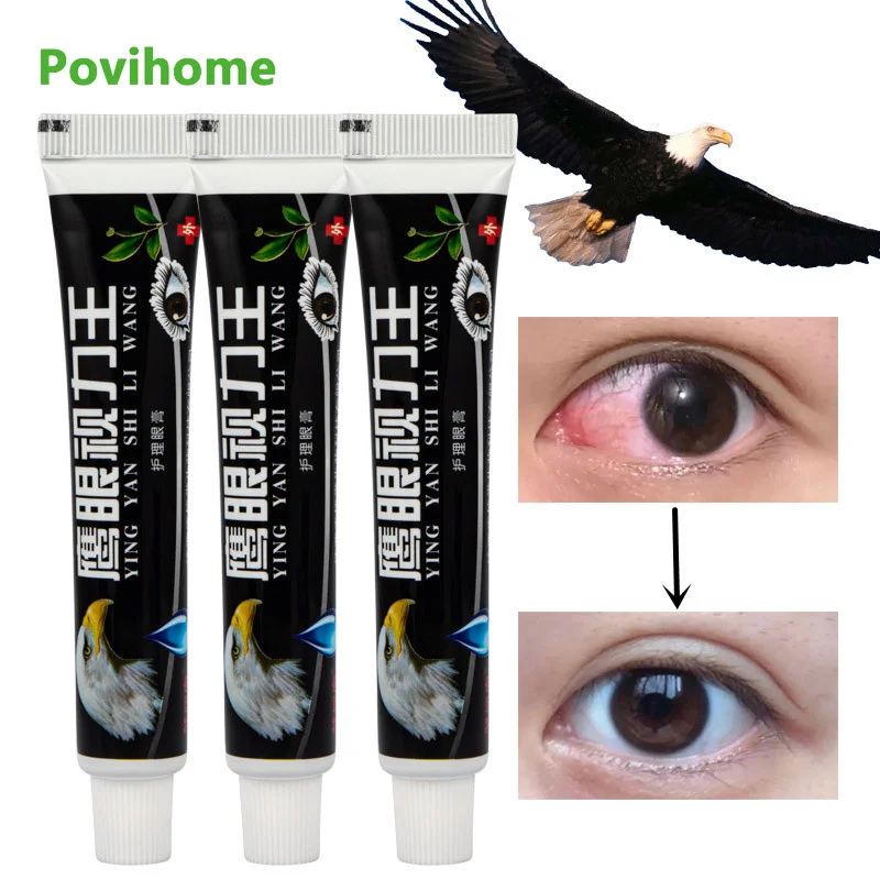 

3pcs Hawkeye Herbal Eye Cream Improve Eyesight Myopia Relieve Eye Fatigue Dryness Ointment Remove For Red Bloodshot Medical 20g