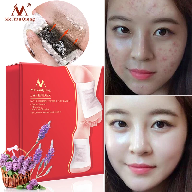 

Детоксикационные накладки для ног, подушечки для снятия стресса, от токсинов на ногах, детоксикации и очищения, удобная уход за здоровьем