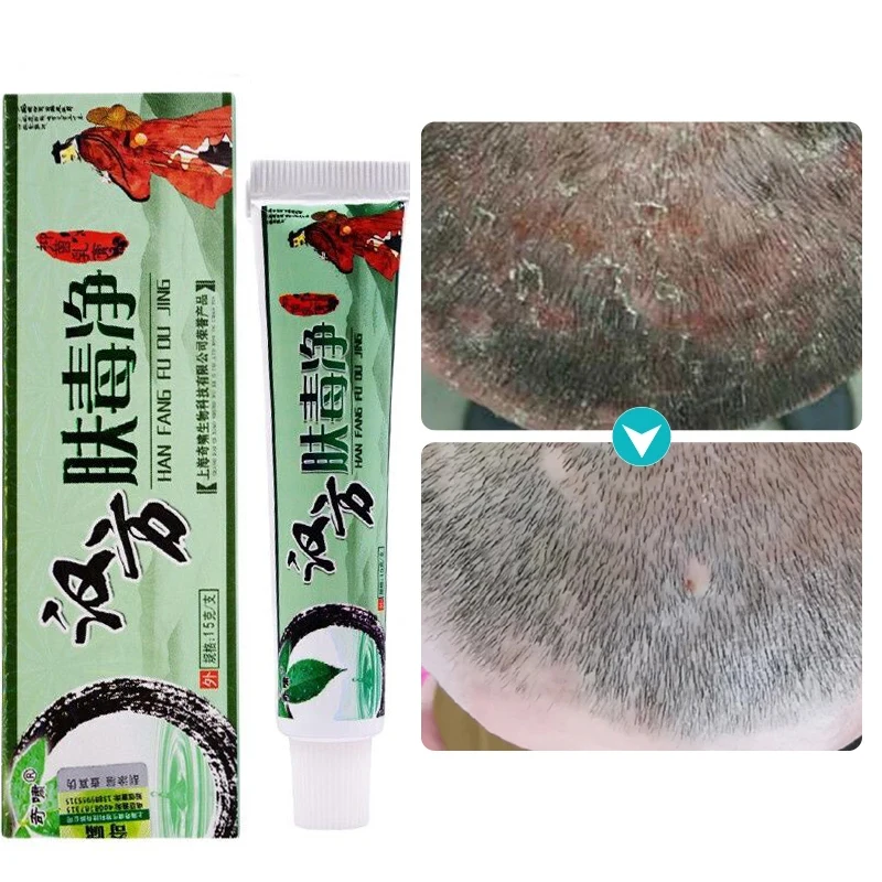 15g Qixiao Hanfang Fudujing Herbal Cream Antibacterial Cream