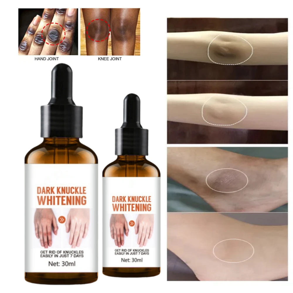 Быстрая осветляющая сыворотка Dark Knuckles эссенция для суставов меланина средство