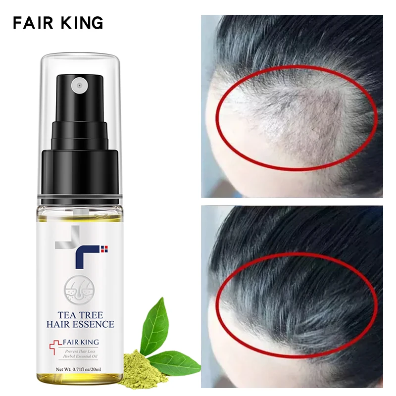 Fast Hair Growth Spray Products Anti Hair Loss Essential Oil Scalp Treatment Prevent Baldness Repair Thinning Damaged Hair Care
