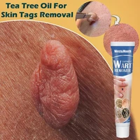 20g warts remover cream herbal treatment skin tag neck armpit flat genital corn wart antibacterial ointment body beauty care