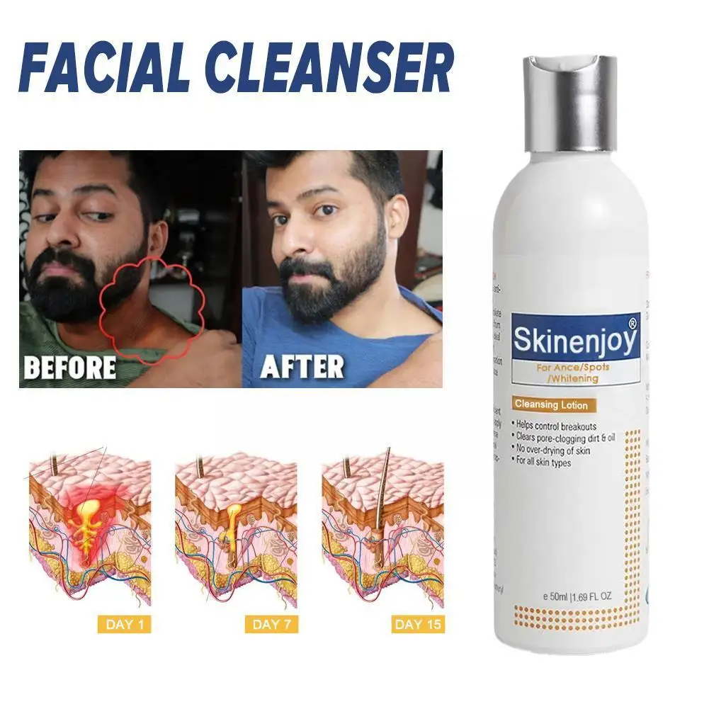 

Skinenjoy Whitening Facial Cleanser Brighten Skin Tone Cleaning Smooth Chloasma Removal Refreshing Foam Fade Wash Face Whitening