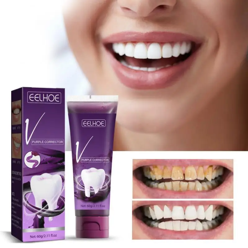 

Whitening Toothpaste Essence Brightening Toothpaste To Remove Tartar Yellow Stain Smoke Stains Teeth Cleaning Oral Hygiene Tools