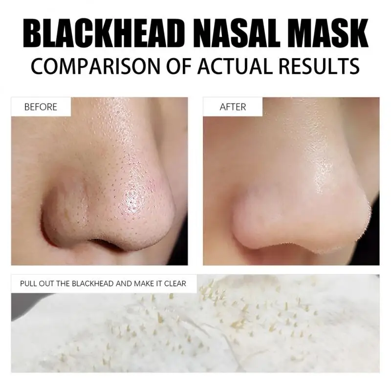 

LANBENA Blackhead Remover Nose Face Mask Shrink Pores Strip Tearing Black Dots Mask Peeling Acne Pore Deep Cleansing Skin Care