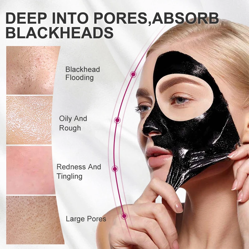 Средство для удаления черных точек с манго лечение акне контроль жирности носа