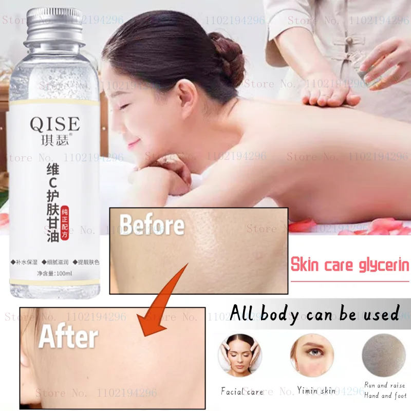 

Уход за кожей с витамином C, глицерин, увлажняющее и питающее средство для тела, крем для лица, гель, крем для рук, увлажняющий и питательный з...