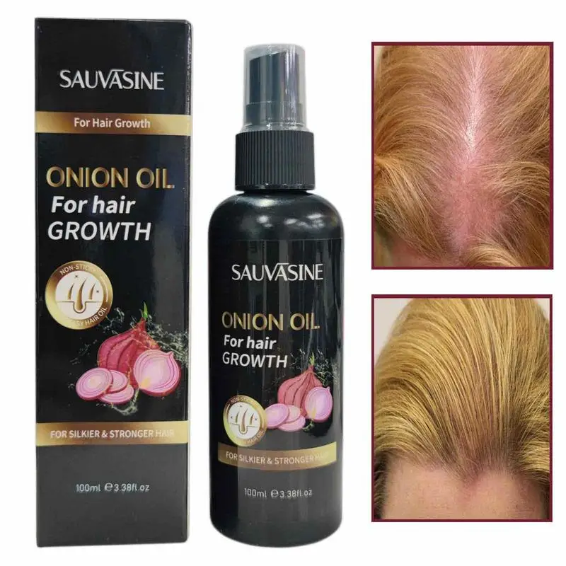 

Onion Oil For Hair Growth Regrowth Anti Hair Loss Prevent Hair Thinning Dry Frizzy Repair Damaged Hair Care Products 100ml