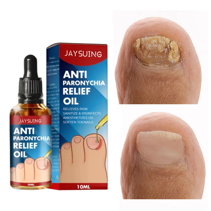 

Sdotter Repair Nail Fungus Treatments Essence Foot Care Serum Toe Nails Fungal Removal Gel Anti-Infection Onychomycosis