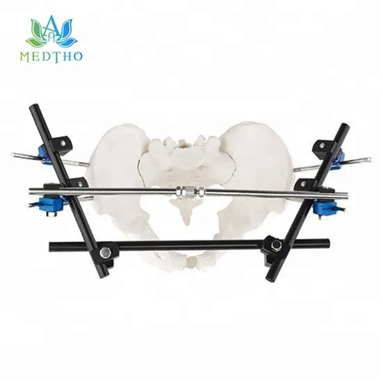 

orthopedic external fixation external fixator Pelvic External Fixator