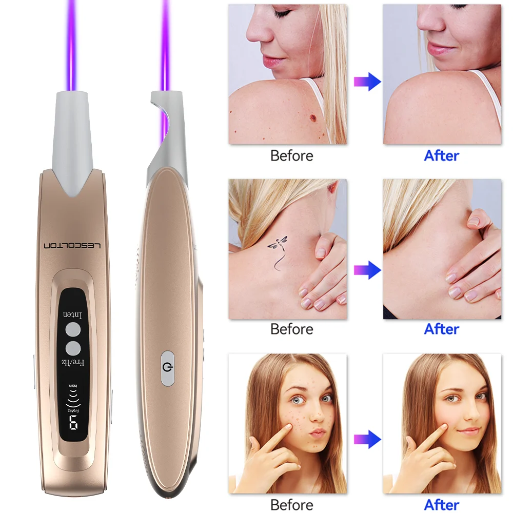 Лазерная ручка-пикосекунда LESCOLTON улучшенное синее устройство для фототерапии