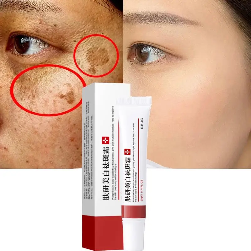 

Remove Melasma Remove Dark Spots Melanin Melasma Remover Brighten Skin Anti-Aging Whitening Freckle Cream Skin Lightening 20g