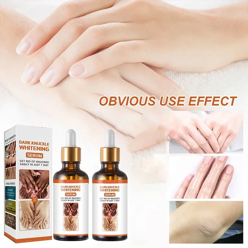 Отбеливающая Сыворотка для тела отбеливающая масляная суставов осветляющая