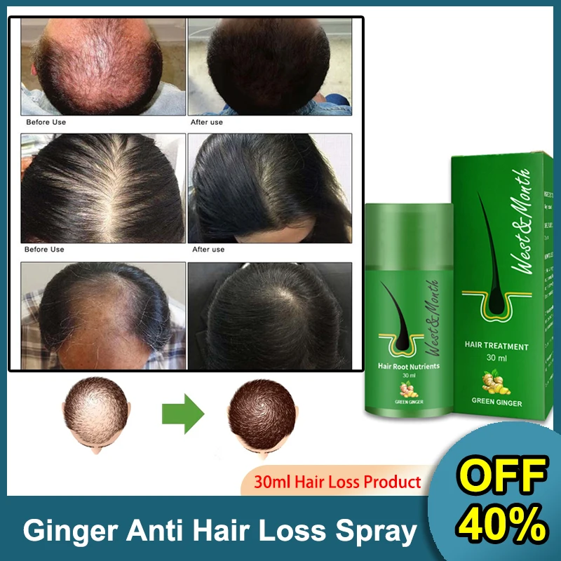 

30ml Hair Growth Products Ginger Anti Hair Loss Spray Serum Anti-loss Oil Scalp Dry Frizzy Treatment Strong Root Essential Oils