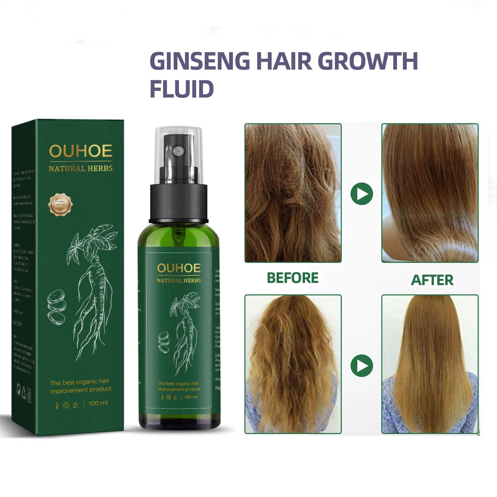 

OUHOE Ginseng Hair Growth Solution Oil Neo Genuine Ginseng Extract Hair Growth Spray Strengthening Hair Moisturizing Anti-Fall