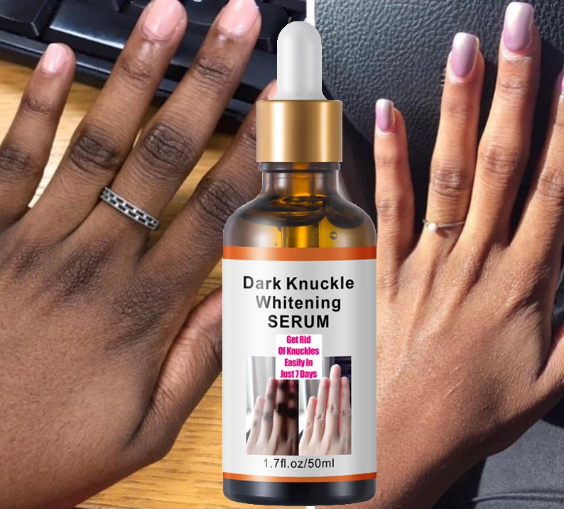 

Dark Knuckle Whitening Serum Strong Intense Knuckle Removal Whitening Removing Dark knuckles Serum for Elbow and Knee 50ML