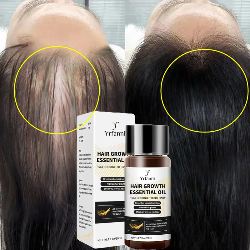 

Fast Hair Growth Essential Oil Anti Hair Loss Treatment Prevent Thinning Repair Nourish Hair Roots Hair Care Serum For Men Women