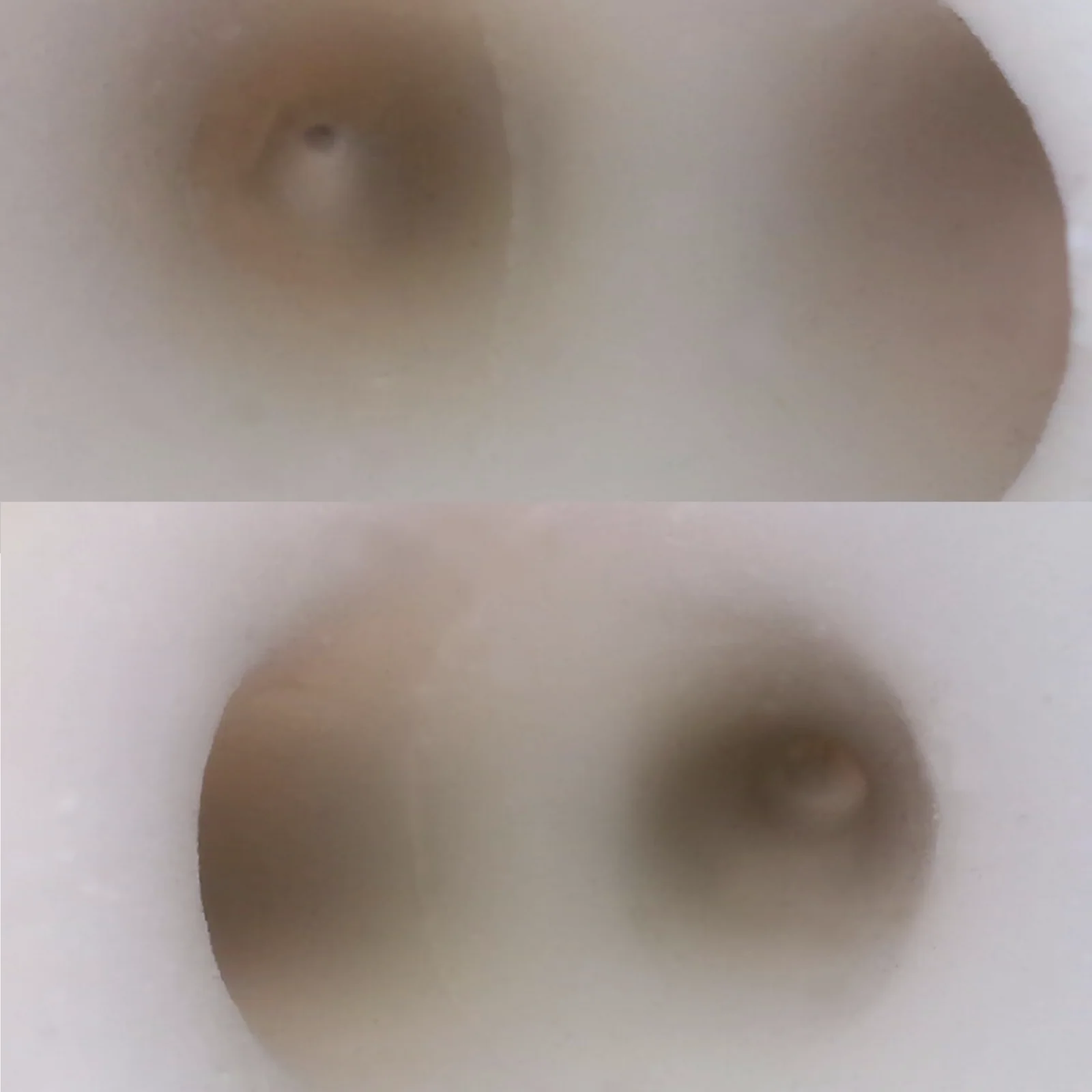 KyrenMed тренировочный симулятор бронхоскопии волокнистая Бронхоскопия вторичная