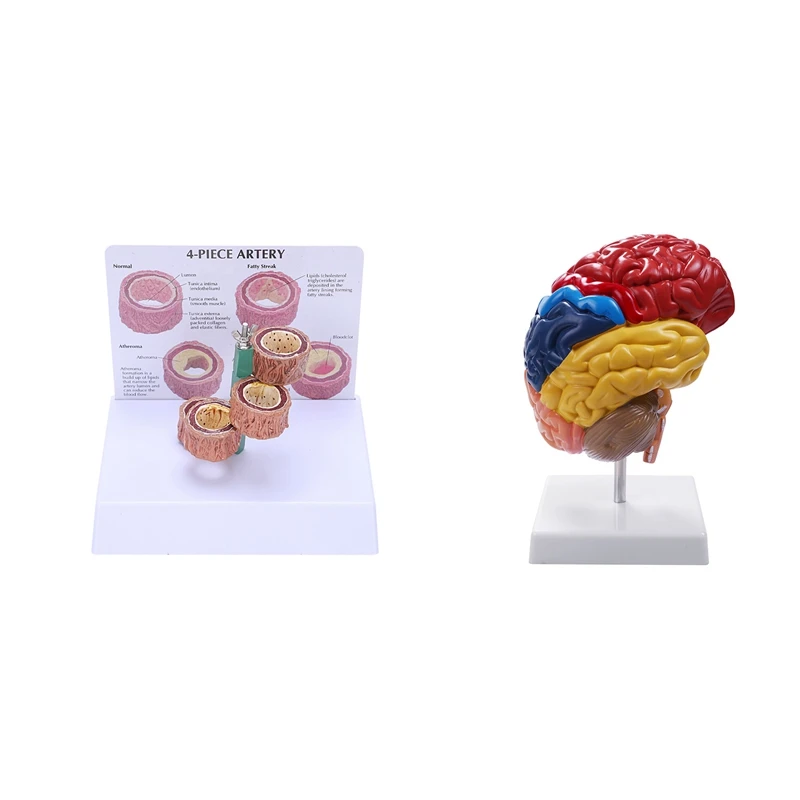 

1 Pcs Vascular Pathology Model & 1 Pcs Half Brain Brainstem Teaching Model