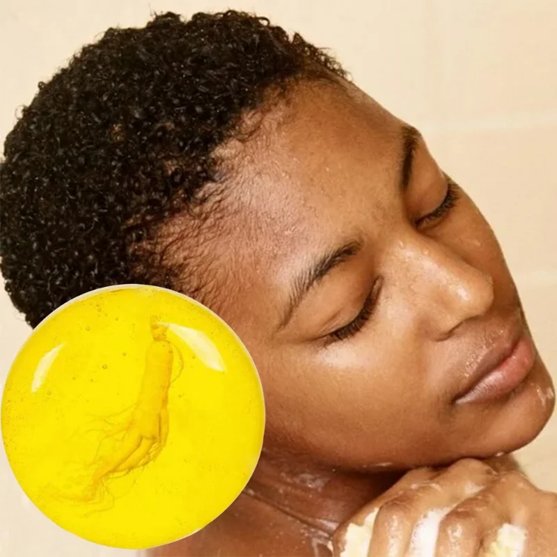 Добавьте акне прыщи пятна шрамы корректор темных пятен афроамериканское мыло