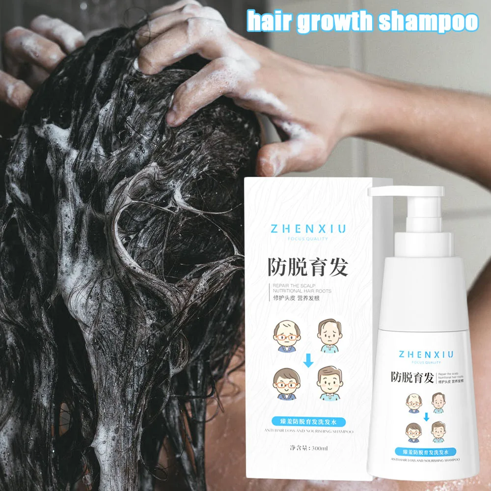 

300Ml Hair Growth Shampoo Herbs Anti Hair Loss to Make Hair Thicker And Longer Hair Growth Hairline Treatment Hair Care Product
