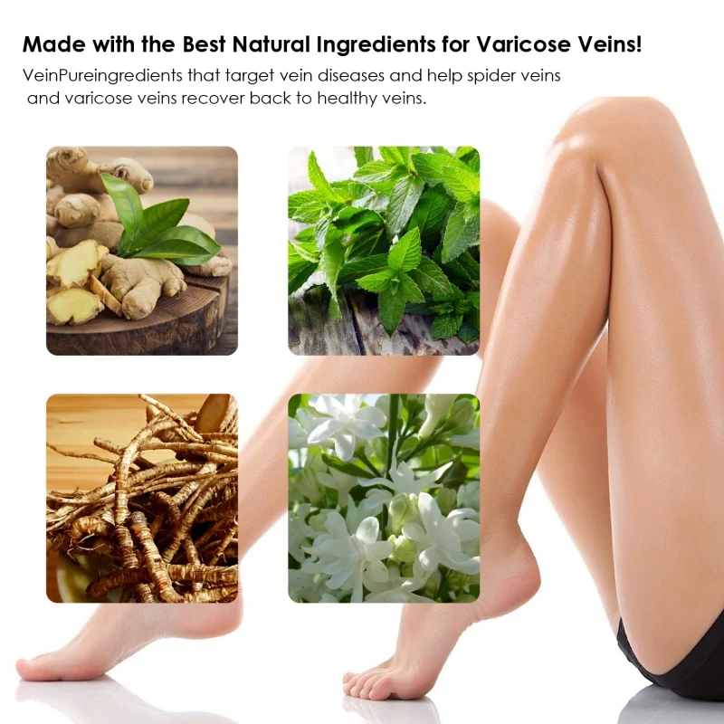 New Varicose Veins Gel Spider Treatment Relief for Legs Repair Natural Massage | Body Creams