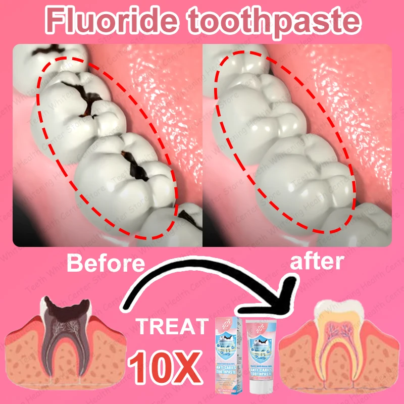 99 9% Teknik sazi azi אור