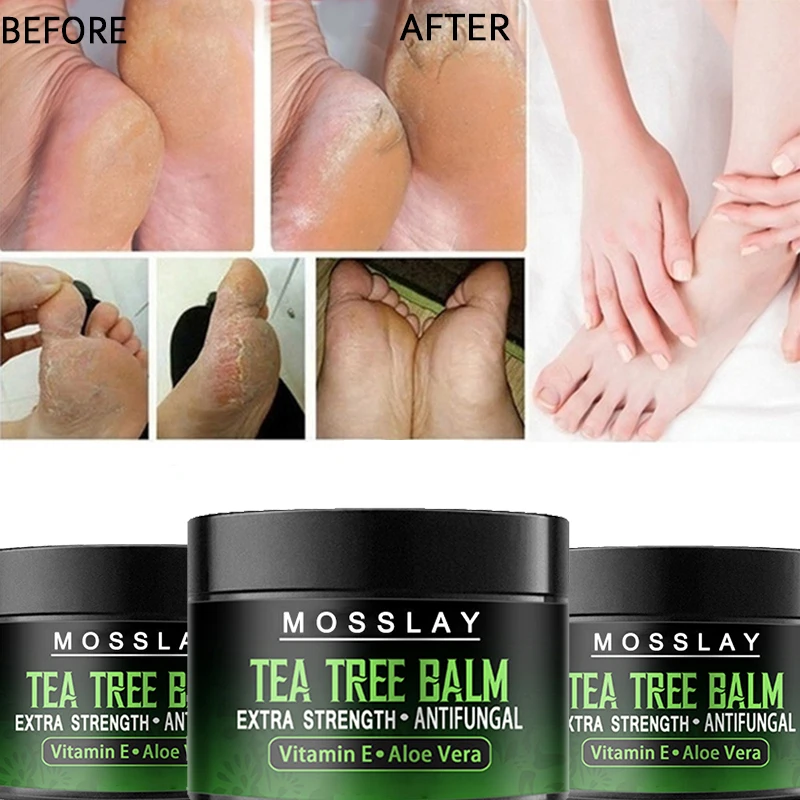 best foot cream