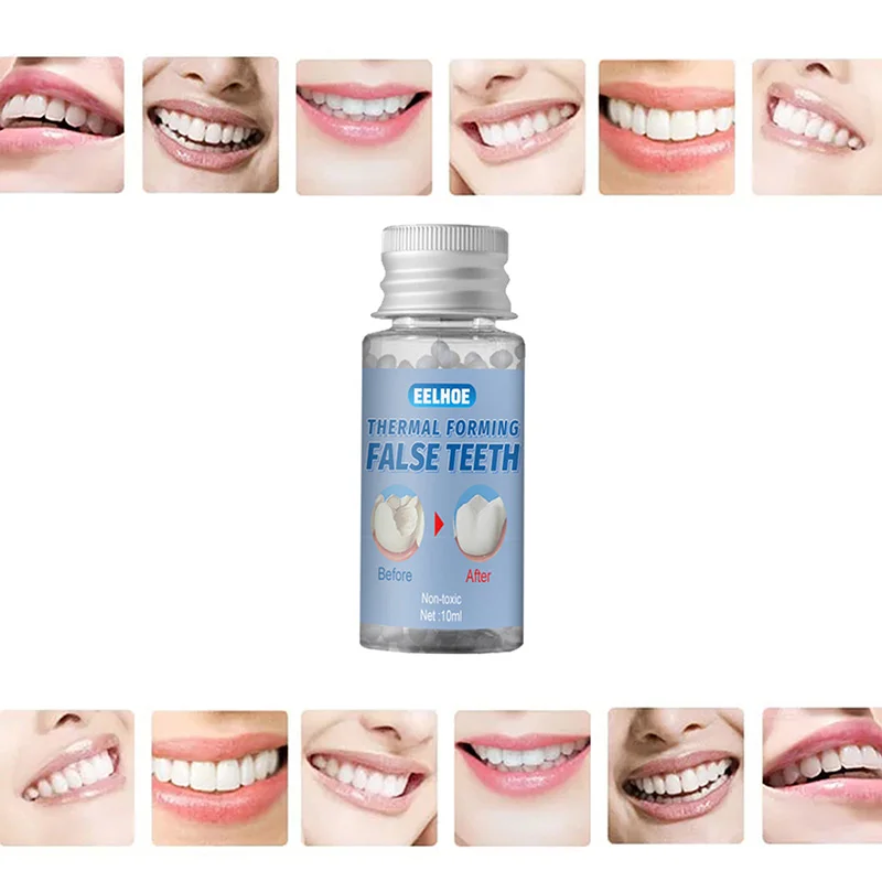 

10/20/30g Denture Adhesive Glue Temporary Tooth Repair Kit Solid Glue Denture Adhesive Tooth Replacement Filling Material