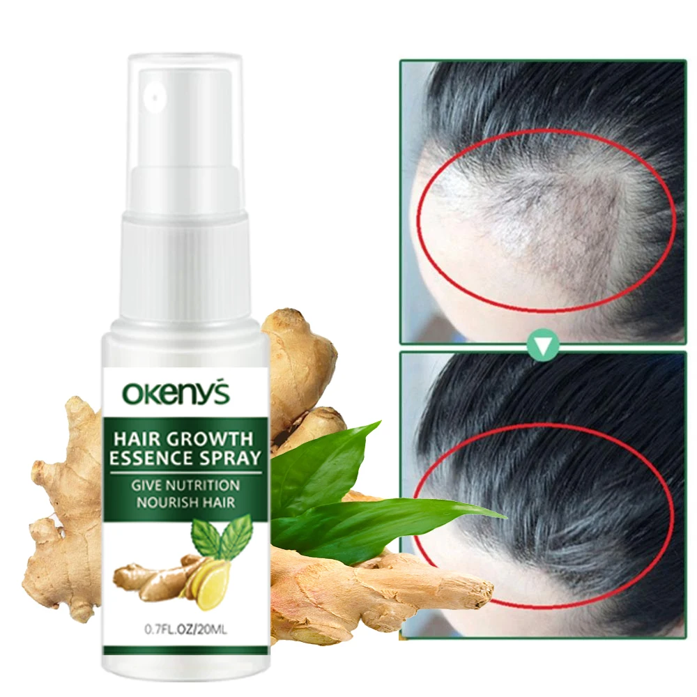 Ginger Hair Growth Essence Spray Anti Hair Loss Products Prevent BaldnessTreatment Thinning Dry Frizzy Repair Beauty Health Care