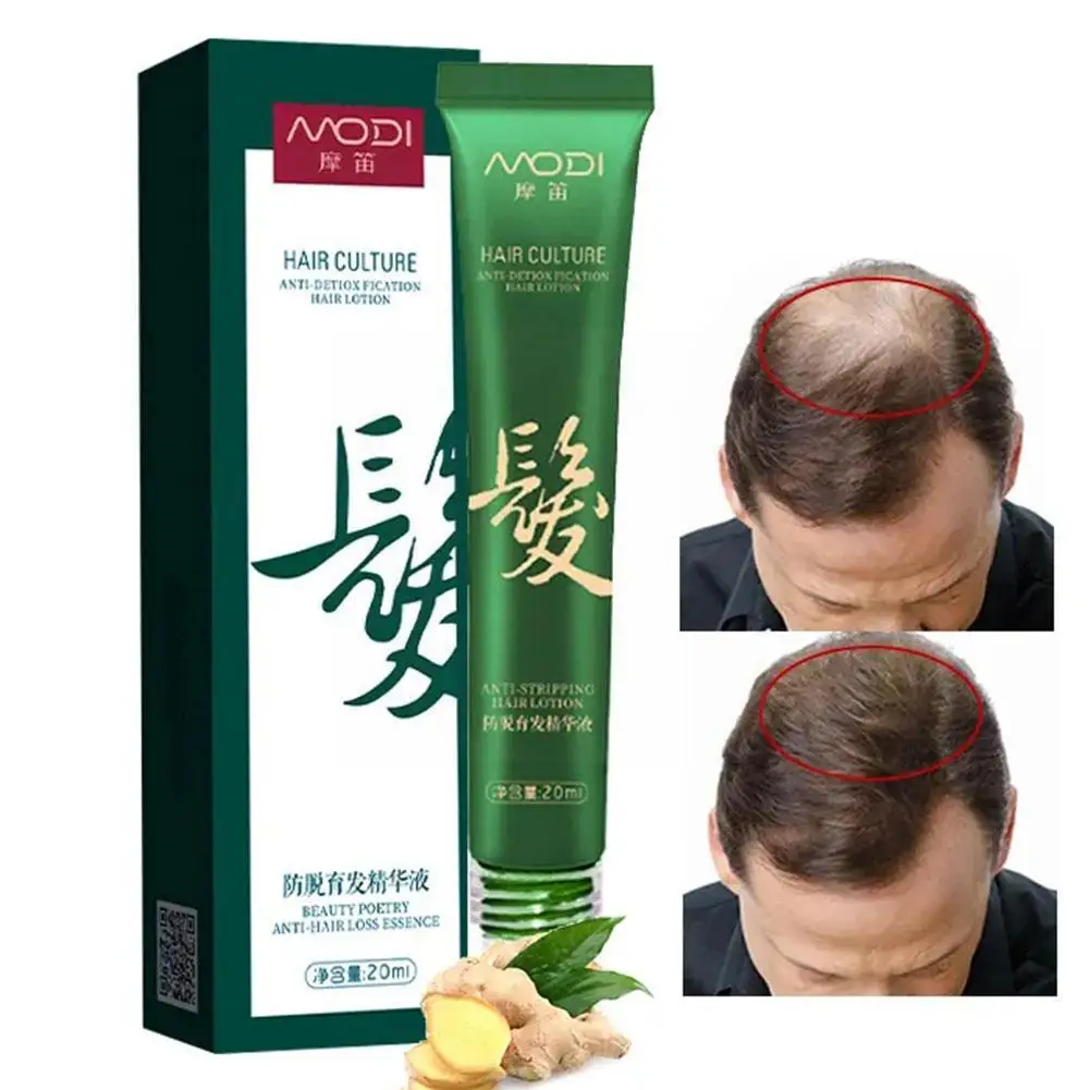 

20ml Anti-hair Loss Essence Fast Oil Hair Hair Treatment Liquid Regrowth Reduce Thinning Growth Serum Hair Dand S1A6