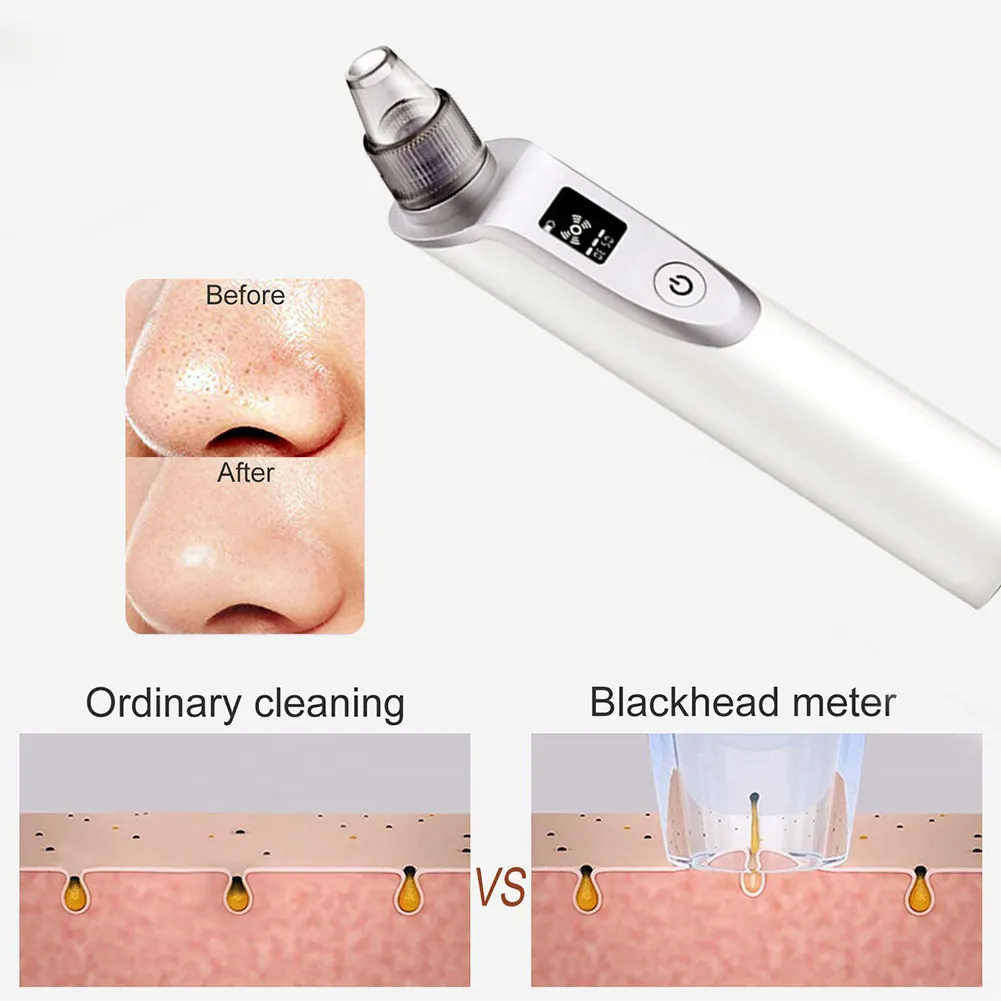 Baby Nasal Aspirator Adjustable suction Nose Cleaner Newborn infantil Safety Sanitation Nasal dischenge patency tool #WO