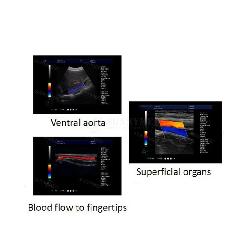 SY-A046 Больница Портативный цветной доплеровский сканер Echographie Инструменты