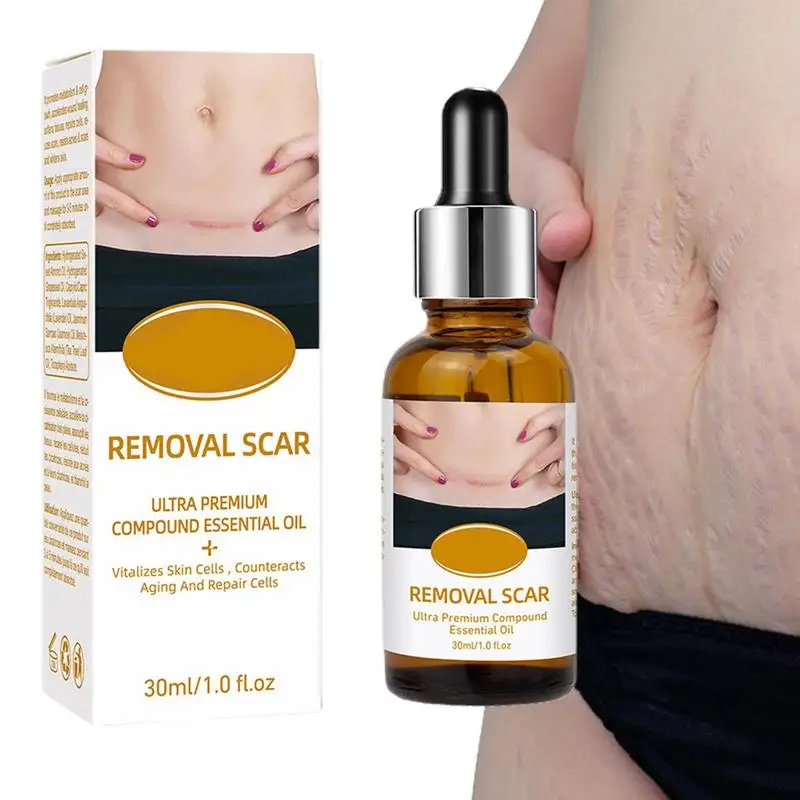 

Scar Removal Oil Scar Oil For Surgical Scars Skin Moisturizing Oil Effectively Reduces The Look Of Scars Stretch Marks & Dark