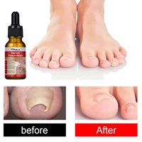 ingrown toenail treatment serum nail correction recover oil pain reliever nail softener trim with ease oil feet health care safe