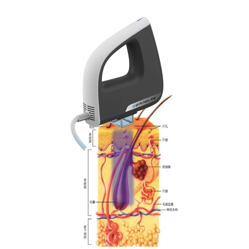 Медицинская больничная машина для ухода за больнице 308 нм Эксимерная терапия