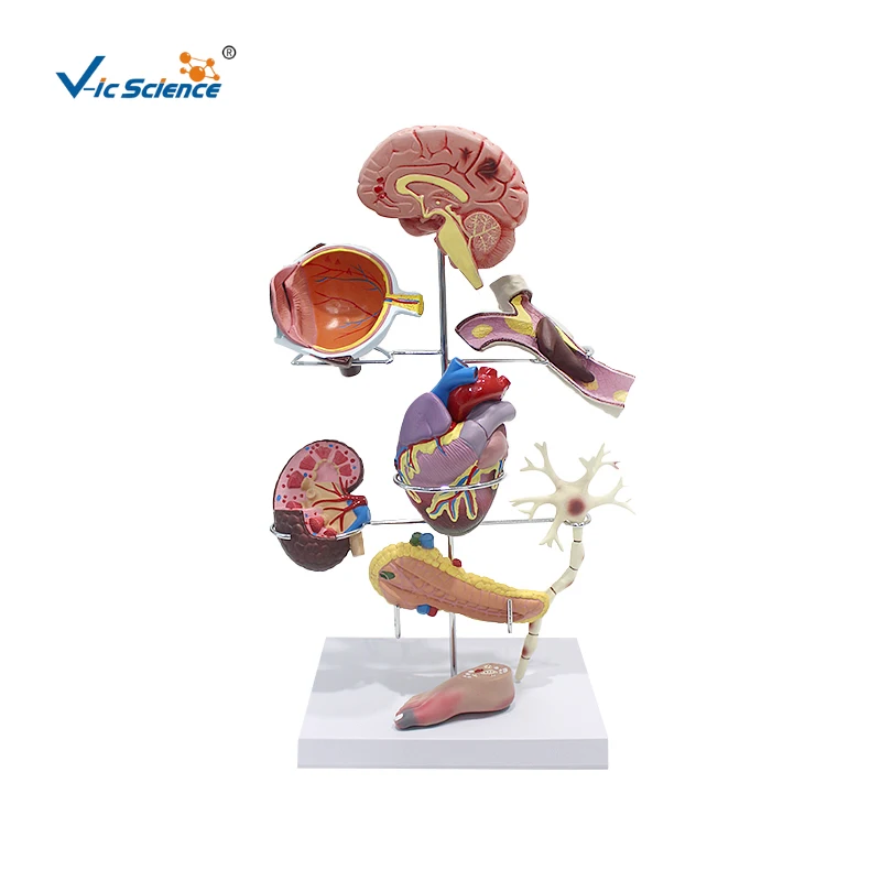 Модель для диабетиков медицинская научная обучающая анатомическая