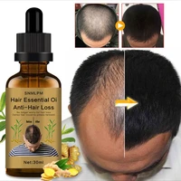 ginger hair nutrient 30ml nourishing hair and preventing hair loss ginger hair scalp nourishing fluid free shipping