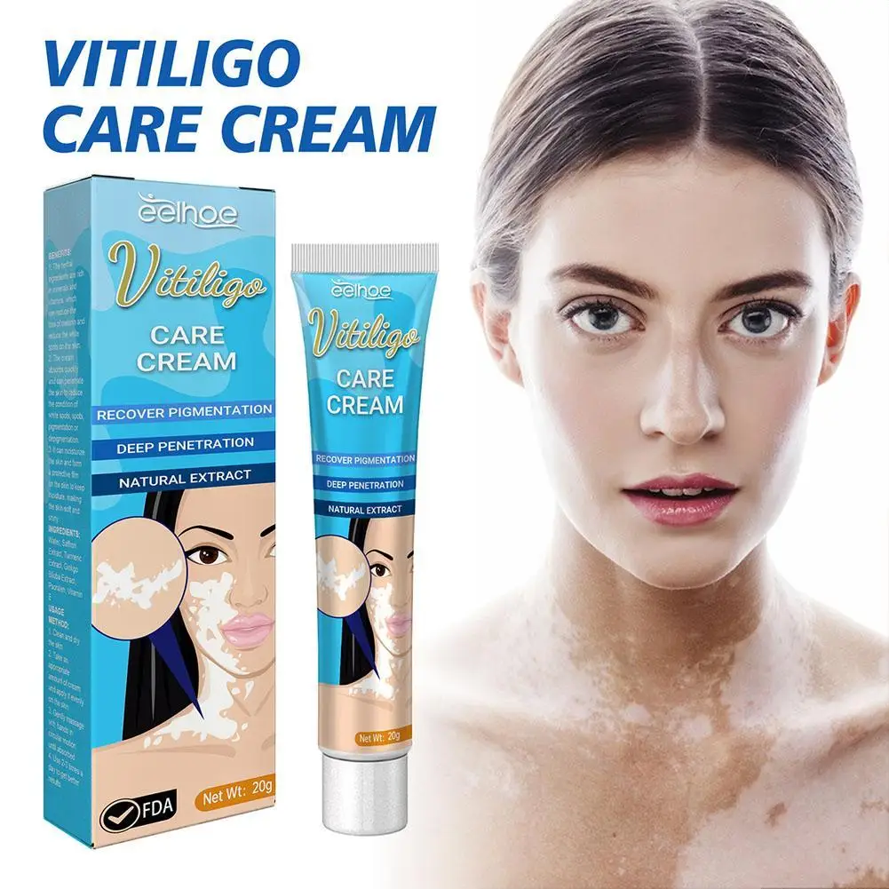 

20g Herbal Extract Vitiligo Ointment Remove Ringworm White Spot Removal Skin White Spot Leukoplakia Disease Treatment Cream