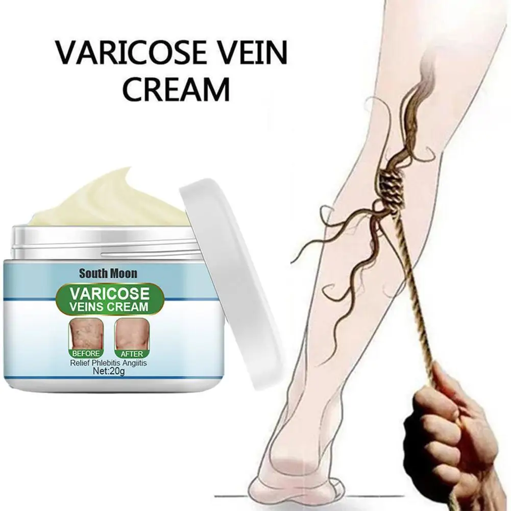 

20g Leg Varicose Veins Tighten The Skin Natural Plant Red Blood Silk Moisturizing Repair Cream Vein Repair To Relieve Pain