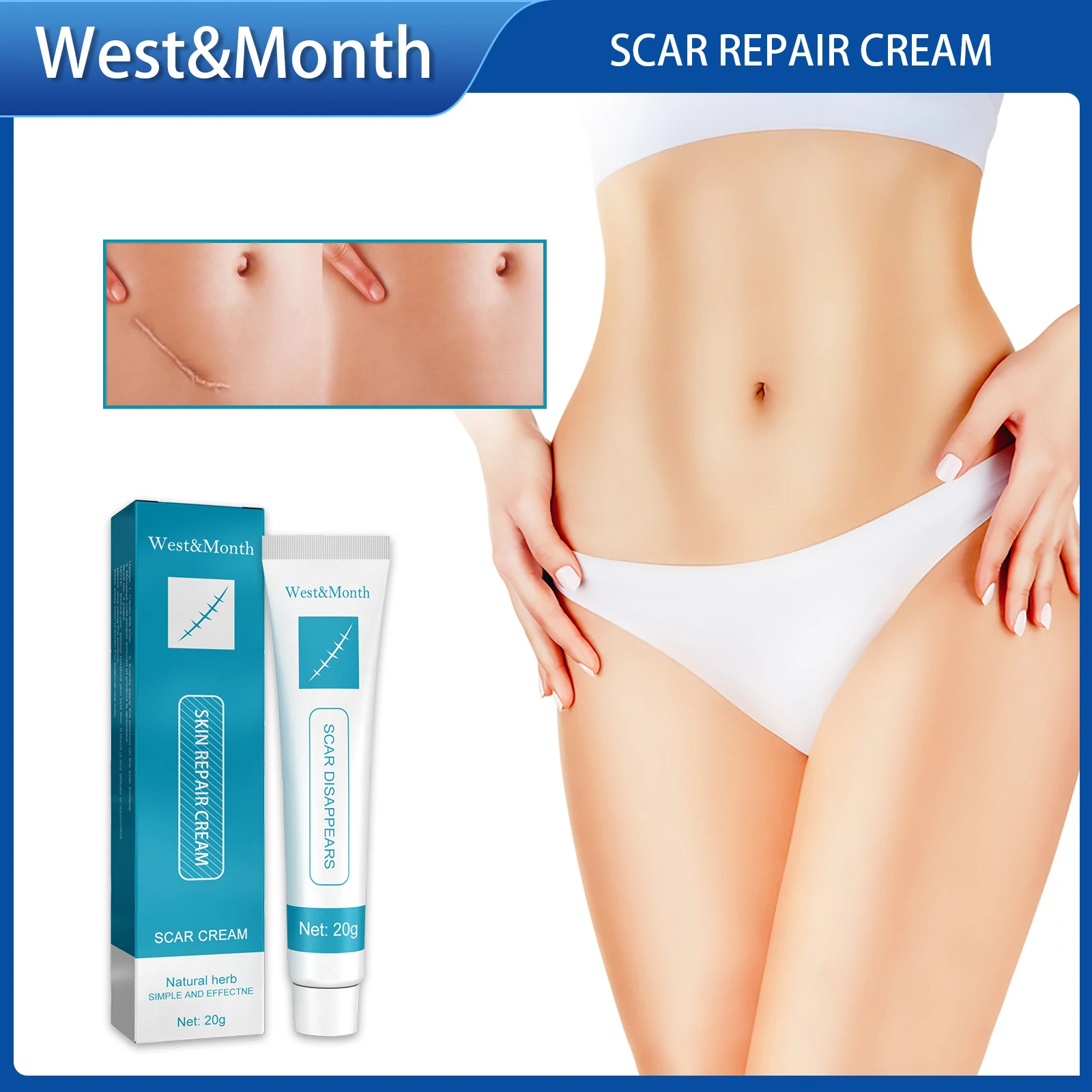 

Herbal Scar Removal Cream Gel Stretch Marks Remove Acne Spots Burn Surgical Scars Treatment Smooth Whitening Face Body Skin Care