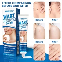 warts remover liquid antibacterial ointment wart treatment cream skin tag remover herbal extract corn plaster warts ointment 20g