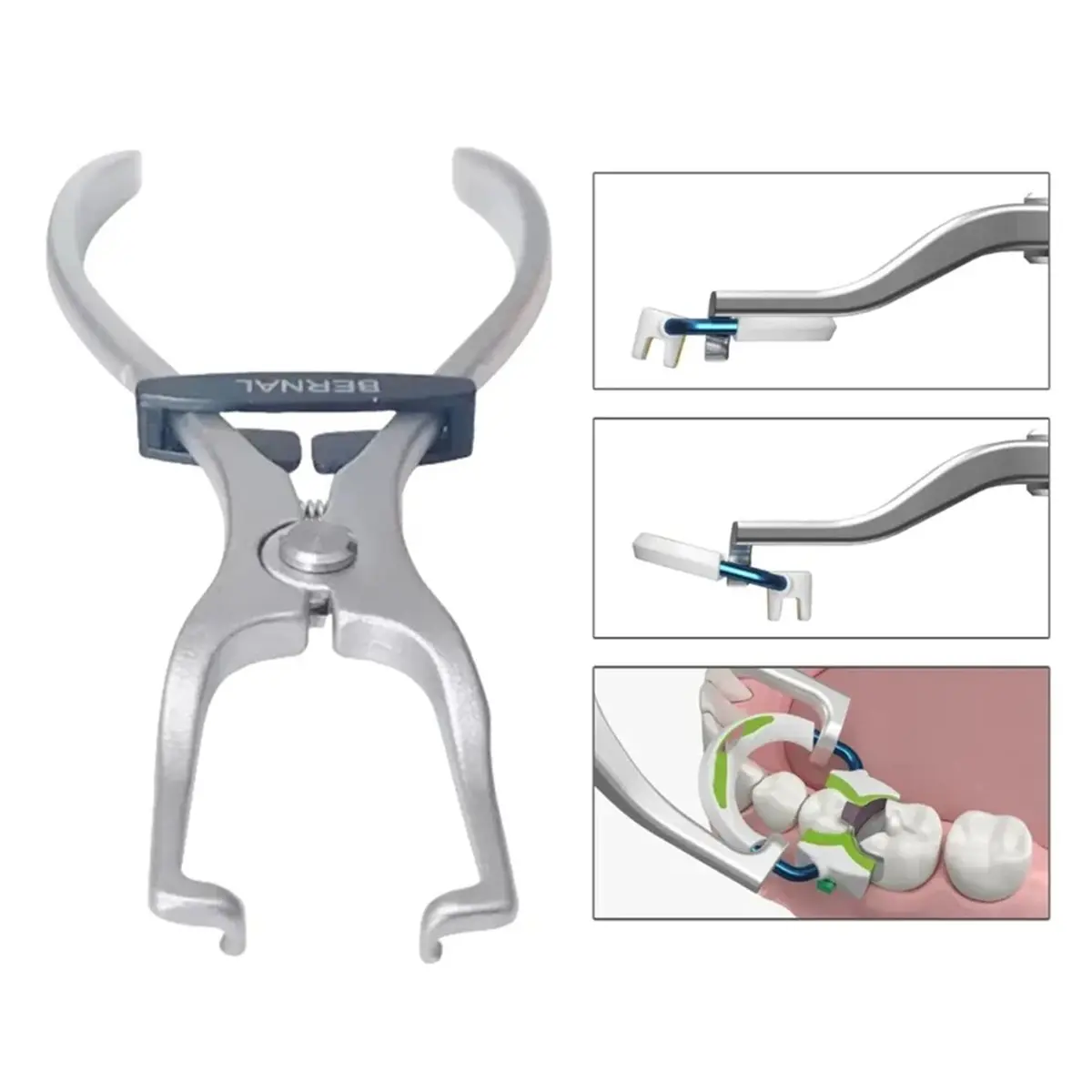 Фото Клещи-пинцеты ABNQ Premium Matrix Ring Forceps для установки кольцевых фиксаторов, сильные разделительные зажимные кольца Wagotrix №1